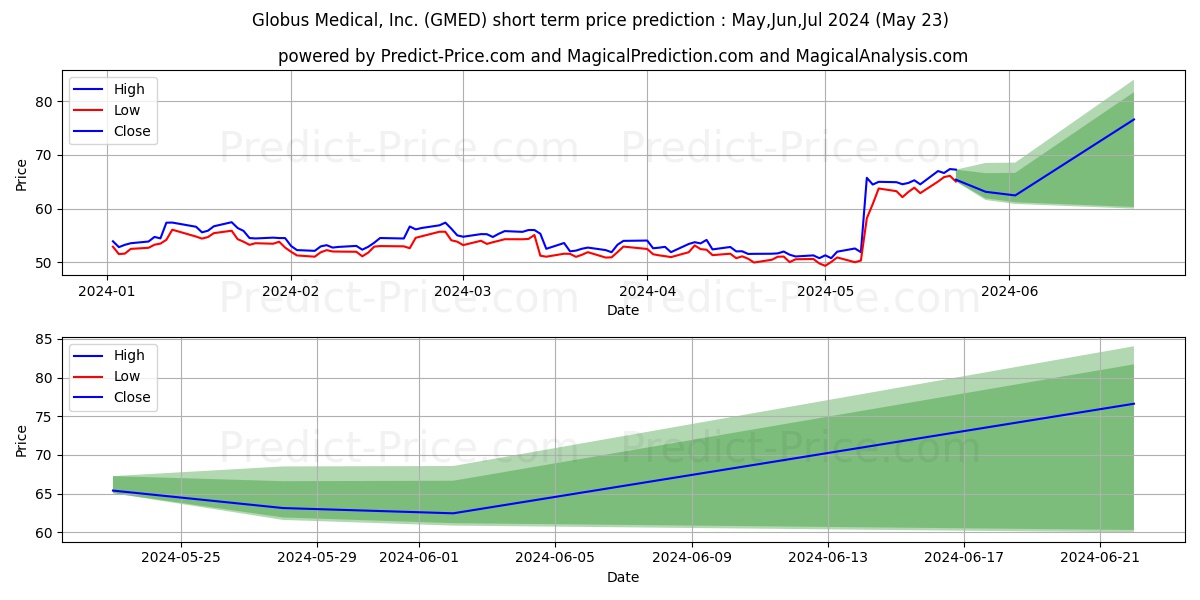Globus Medical, Inc. stock short term price prediction: May,Jun,Jul 2024|GMED: 65.35